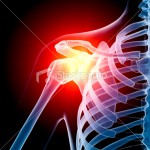 13304765-13304765-shoulder-in-pain-x-ray